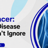 Colon Cancer